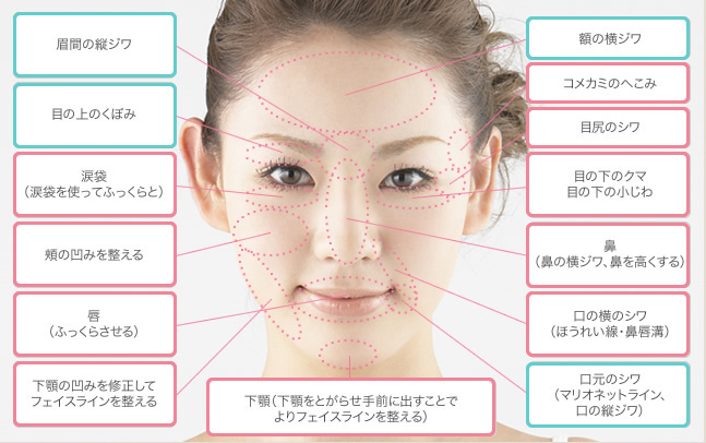 ヒアルロン酸やボトックス注射による施術が可能な部位